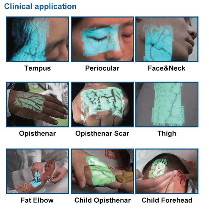 Clinical-Application
