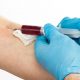 Hemochromatosis Treatment assisted by vein finder