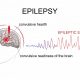 Vein finder use with Epileptic patients
