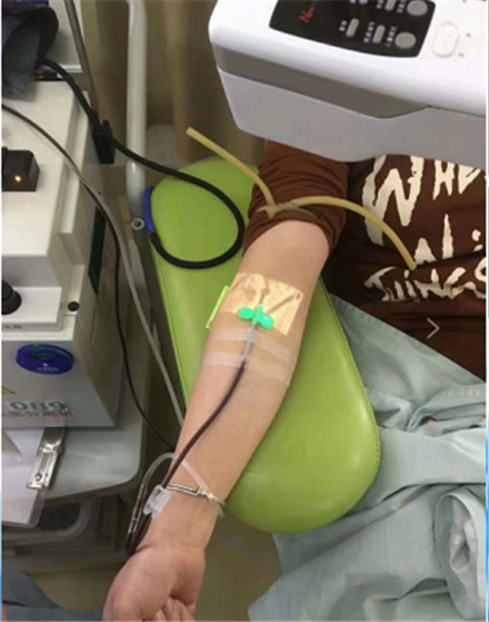 Efficacy of Vein Finder to facilitate IV contrast
